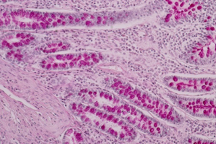 Bacteria under a miscroscope.